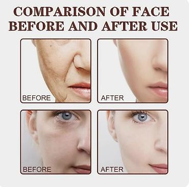 Уход за телом: США Крем укрепляющий с черным чаем и решение 5 проблем кожи — 5