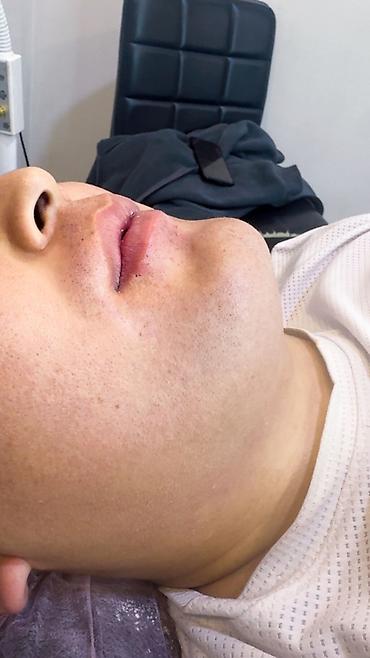 Эпиляция: Мужской шугаринг. Восковая депиляция — 10