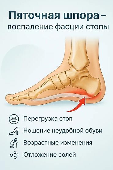 Личные вещи: Скидки!!!💐💐💐 Магнитный пластырь от пяточной шпоры «Гэнтон Пин» — 4
