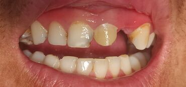 врач стоматолог: Врачи, Клиника | Стоматолог | Протезирование