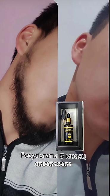 Уход за телом: Миноксидил ультра 15% 100мл 3 месяц хватает Для бороды и волосы — 17