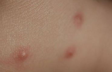 Дезинфекция, дезинсекция: ОсОО "ДЕЗМАСТЕР" . Производим качественную обработку против тараканов — 8