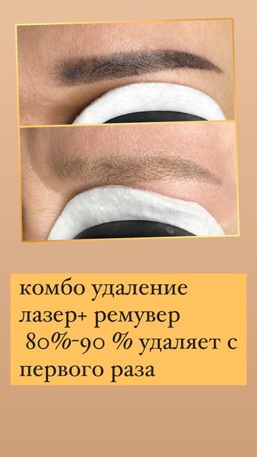 брови модели: Лазерное удаление татуажа бровей и ремувером 80%-90% с первого раза