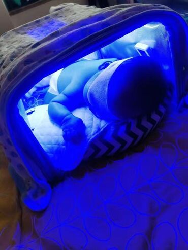 ультрафиолетовая лампа от желтушки: Фотолампа от желтухи ! Одним из самых эффективных методов лечения