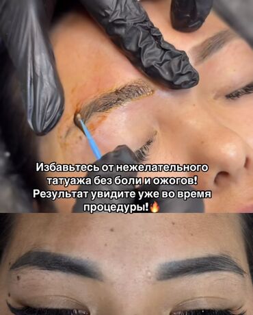 Перманентный макияж: АКЦИЯ !АКЦИЯ! Новый метод удаления Сейчас по акции Лазерное удаление — 6