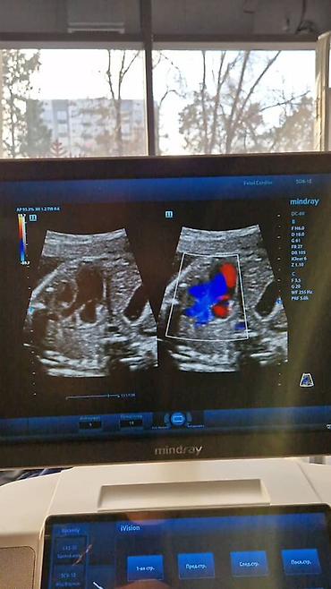 Медицинское оборудование: Продаётся УЗИ аппарат экспертного класса Mindray DC-80 X-INSIGHT — 7