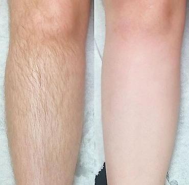 Эпиляция: ТОЛЬКО ДЛЯ ЖЕНЩИН Шугаринг и восковая депиляция Услуга — 2