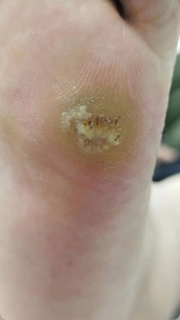 Маникюр, педикюр: Коррекция вросших ногтей, Педикюр, Услуги подолога, Консультация, Одноразовые расходные материалы — 20