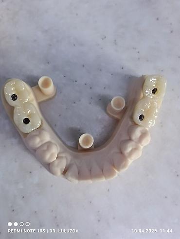 Медицинские услуги: Клиника | Стоматолог | Протезирование — 22