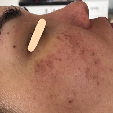 Косметология: Косметология, Чистка кожи, Биоревитализация, Пилинг, Сертифицированный косметолог, Гипоаллергенные материалы, Консультация — 8