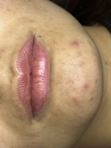 Косметология: Косметология, Маски, Мезотерапия, Удаление носогубных складок, Гипоаллергенные материалы, Консультация, Сертифицированный косметолог — 2