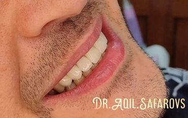 Stomatologiya: 💫Ramazan ayı ilə əlaqədar Kampaniya✨🌟⭐💫 🌊🔥Diş Həkimi 🔥🌊 Qiymətləri — 5