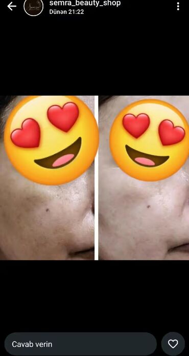 Saçlara qulluq: Saç üçün yağ, Saç tökülməsinə qarşı — 17