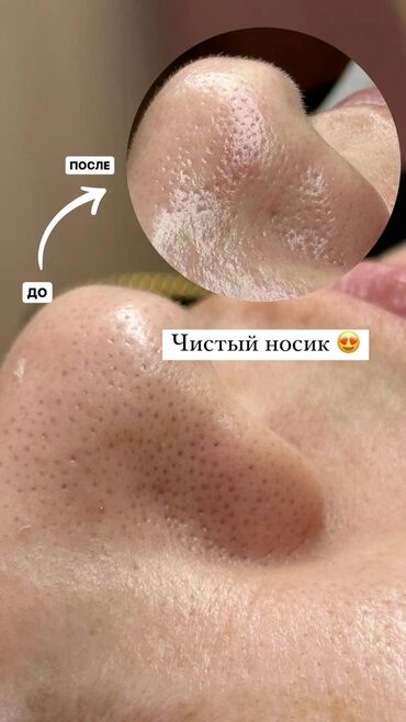 консультация врача по телефону 24 часа бесплатно бишкек: Косметология, Ботокс, Биоревитализация, Ботулинотерапия, Консультация, Гипоаллергенные материалы, Сертифицированный косметолог