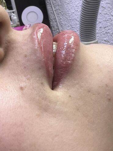 Косметология: Косметология, Маски, Мезотерапия, Удаление носогубных складок, Гипоаллергенные материалы, Консультация, Сертифицированный косметолог — 48