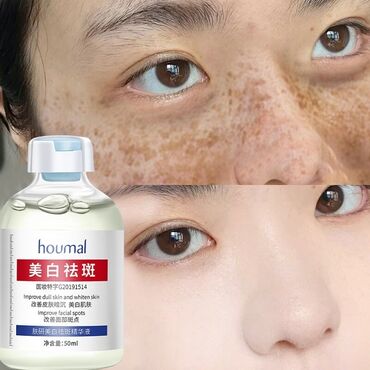 Косметика: От пигментации От пигментных пятен От веснушек Эссенция, поглощающая — 9