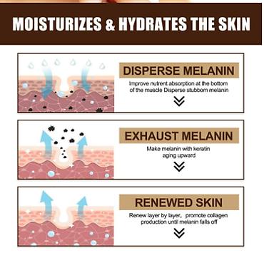 Уход за телом: США Крем интенсивное отбеливание удаление темных пятен веснушек и — 7