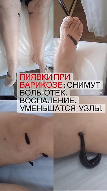 кал центр: Медсестра. Бишкек Парк ТРЦ — 3