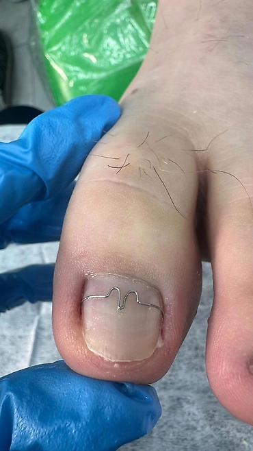 Маникюр: Коррекция вросших ногтей, Маникюр, Педикюр, Услуги подолога, С выездом на дом, Консультация, Одноразовые расходные материалы — 20