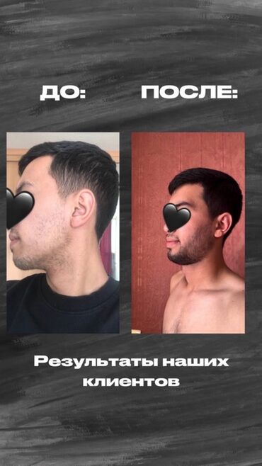 Косметика: Средство для роста волос и бороды - Назначение: усиление роста щетины — 4