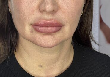 Косметика: Процедура перманентного макияжа губ позволяет придать губам желаемый — 12