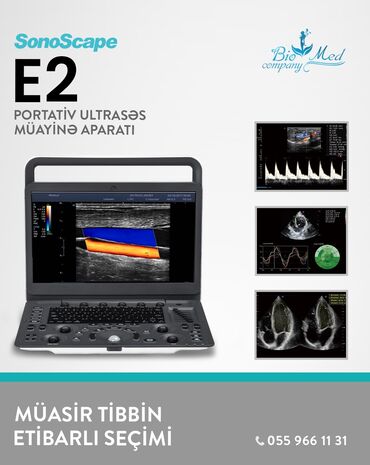 вытяжка для туалета: Model: Sonoscape E2 İstehsalçı: SonoScape Medical Corp (Çin) Tip