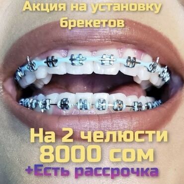 флипчарты ikea для письма маркером in Кыргызстан | ДРУГИЕ АКСЕССУАРЫ ДЛЯ КОМПЬЮТЕРОВ И НОУТБУКОВ: Стоматолог | Брекет системы, пластинки | Консультация