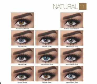 Digər: Linzarin satışı. Çatdırılma mövcuddur — 5