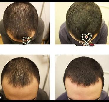 pantene: Saç spreyi Yeni — 2