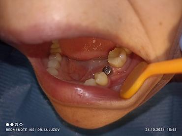 Медицинские услуги: Клиника | Стоматолог | Протезирование — 18