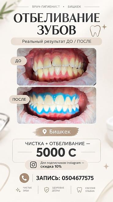 работа стоматолог бишкек: 🦷 БИШКЕК, ЭТО ПРЕДЛОЖЕНИЕ ДЛЯ ВАС! 🗣️ПРОФЕССИОНАЛЬНАЯ ЧИСТКА + — 1