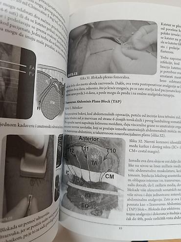 Knjige: Terapija bola – Priručnik (VMA) Stručno izdanje posvećeno savremenim — 5