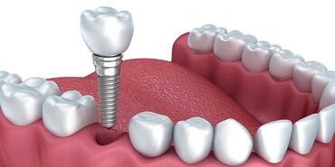 услуги портного: Стоматолог | Имплантация зубов, Другие услуги стоматолога | Консультация, Круглосуточно