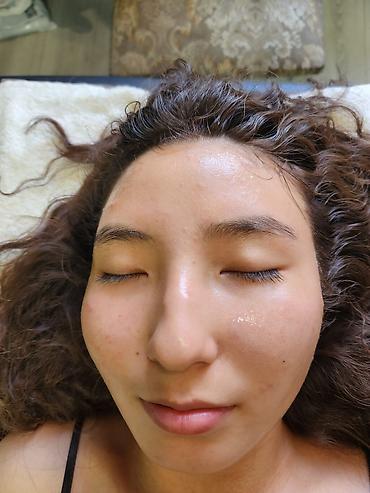 clean point: Косметология, Чистка кожи, Консультация — 3