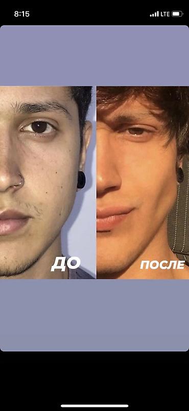 скулер: Эспандер для скулы ( жаак чыгарыш учун ) Ош шаарында доставка бекер — 3