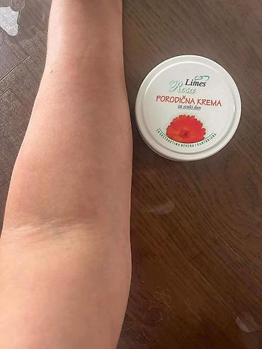 Nega kože: Ide leto,deca su u majicama i sorcicima. Padovi sa — 7