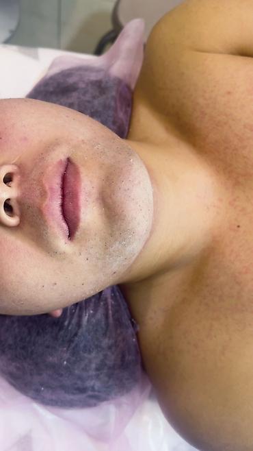 Эпиляция: Мужской шугаринг. Восковая депиляция — 6