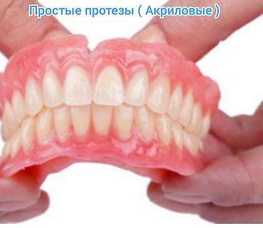 Стоматологи: Съёмные зубные протезы под ваши задачи - Вакуумные протезы: плотная — 17