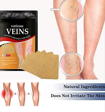 jastuče za hemoroide: Flasteri za proširene vene – Varicose Veins Health Care Paste - — 1