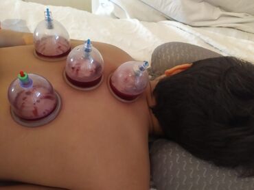 Hicama, zəli: Hicama, quru və yaş vakuum masajı, həmçinin zəli ilə müalicə xidməti — 7