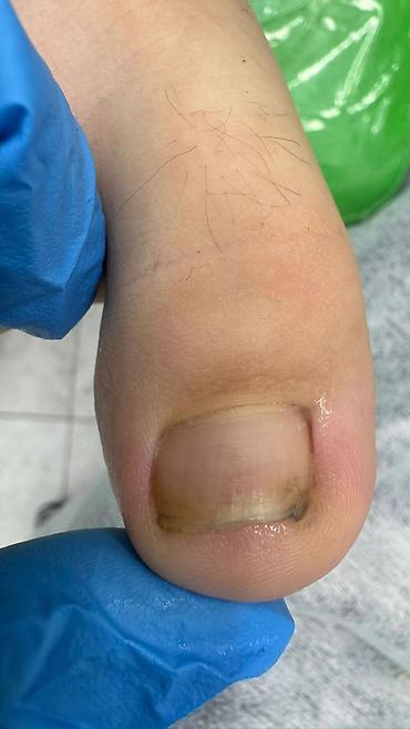 Маникюр: Коррекция вросших ногтей, Маникюр, Педикюр, Услуги подолога, С выездом на дом, Консультация, Одноразовые расходные материалы — 2