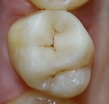 Stomatologiya: Stomatoloq Dr. Feyruz Dadaşovun fərdi praktikadasında böyüklərin və — 3