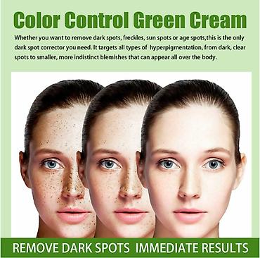 Уход за телом: ❄️ США Крем интенсивное отбеливание с Аmazon и Еbay Крем дает ▶ — 11