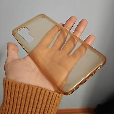 клетка для собак: Чехол на Redmi note 10 lite — 2