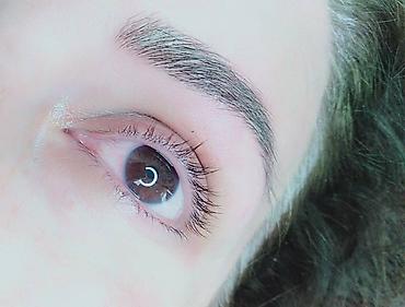 Косметология: Косметология, Ботокс, Биоревитализация, Ботулинотерапия, С выездом на дом, Консультация, Гипоаллергенные материалы — 22