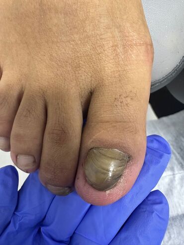 Маникюр, педикюр: Коррекция вросших ногтей, Маникюр, Педикюр, Услуги подолога, Консультация, Одноразовые расходные материалы — 17