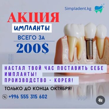чип от домофона цена: Импланты зубов – акция. • Стоимость: всего за 200$ • Производство