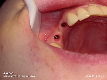 Медицинские услуги: Клиника | Стоматолог | Протезирование — 4