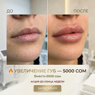Перманентный макияж: Акварельный перманентный макияж губ - Естественное выравнивание тона — 13