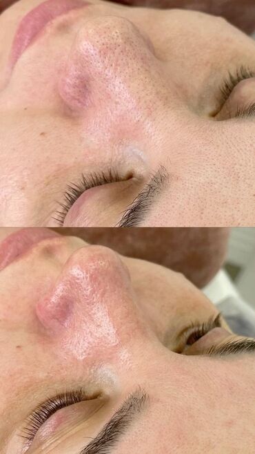 шеллак наращивание ногтей маникюр: Косметология, Терини тазалоо, Консультация, Гипоаллергендик материалдар, Сертификаты бар косметолог